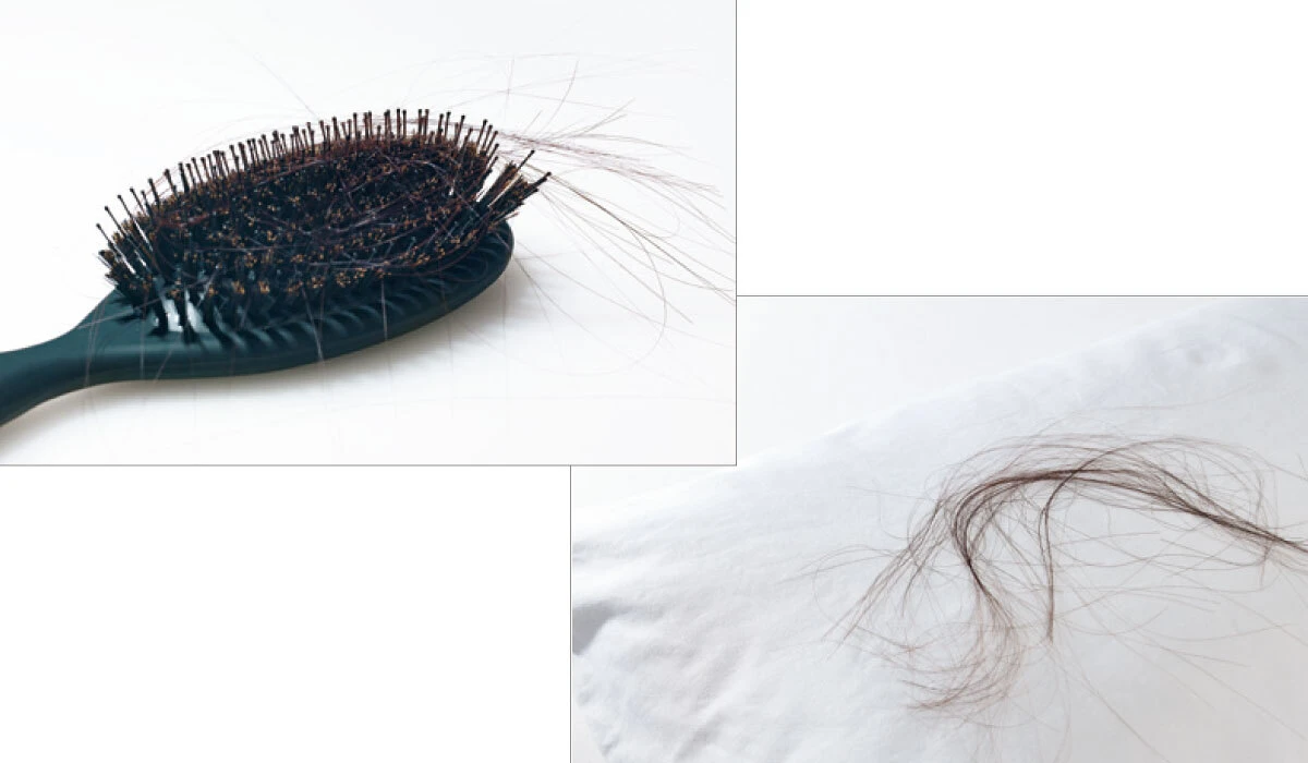 シャンプー後にあれ? 分け目を見てあれ? ドキリとしたら始めどき。育毛ケアの新常識、教えます_3