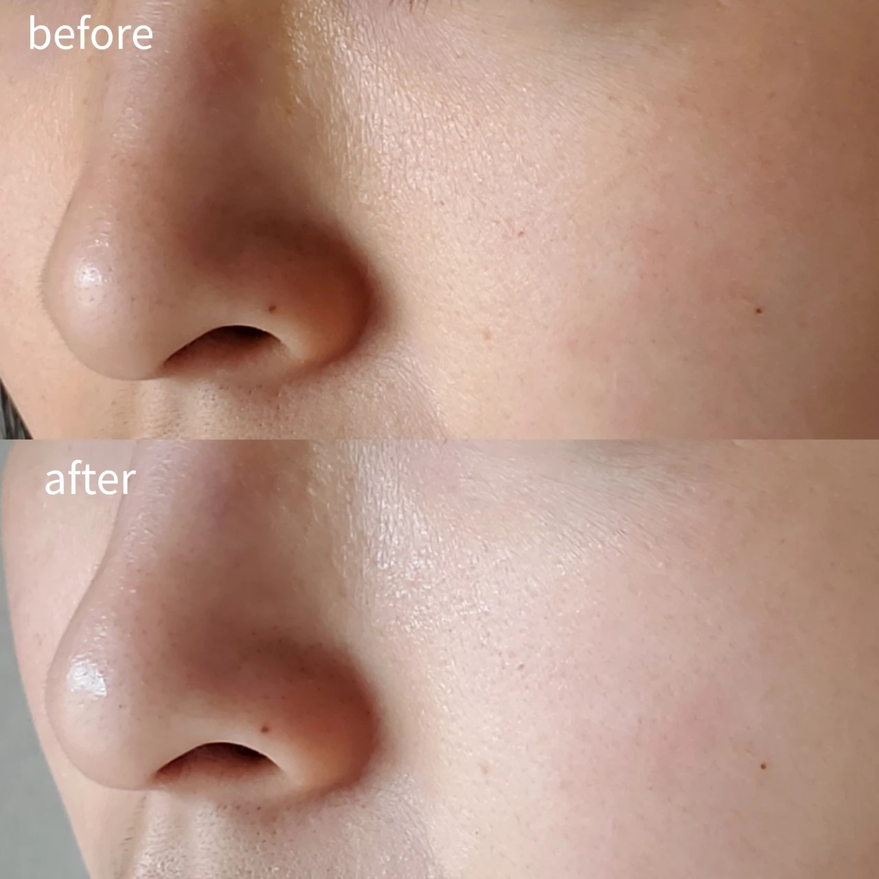 レチノール初心者さんにも!【VT COSMETICS シカレチA エッセンス0.1】でお肌つるん♡【毛穴before afterも公開】_4