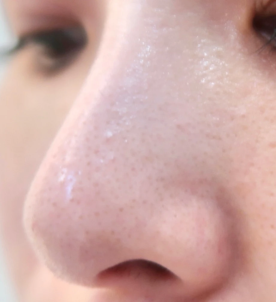 【刺激の少ないレチノールスキンケア♡敏感肌でも初心者でもレチノールケアを始められる！】VT COSMETICS シカレチA エッセンス0.1_5