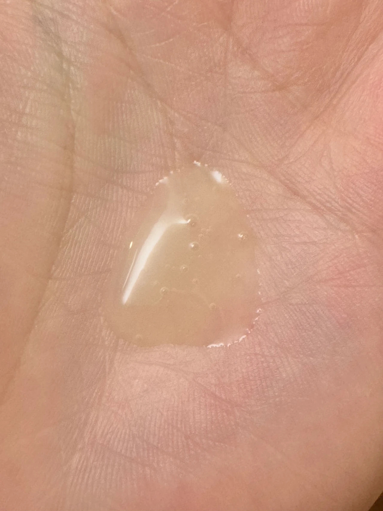 オーディナリー　ナイアシンアミド　美容液　亜鉛