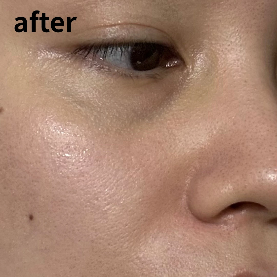 ケアナボーテ VC10で肌印象アップ間違いなしの毎日_2_2