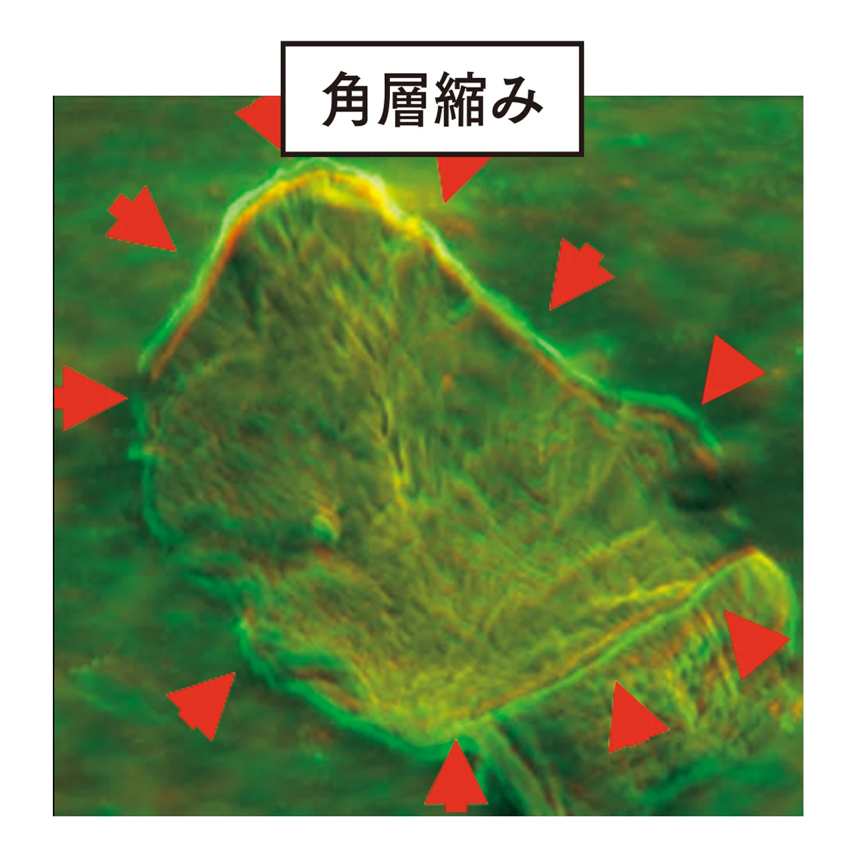 角層縮み 図