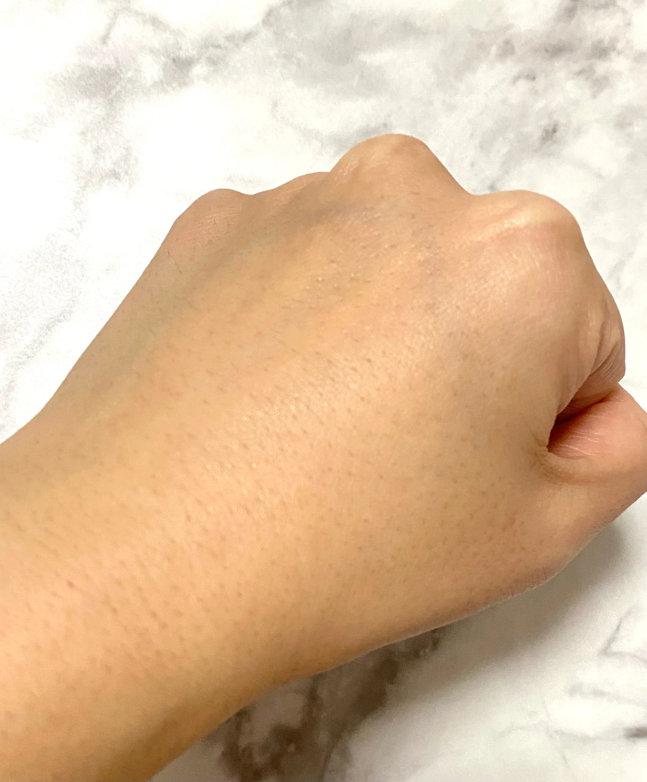 イニクス iniks アドバンスバリアセラム 敏感肌 敏感肌用美容液