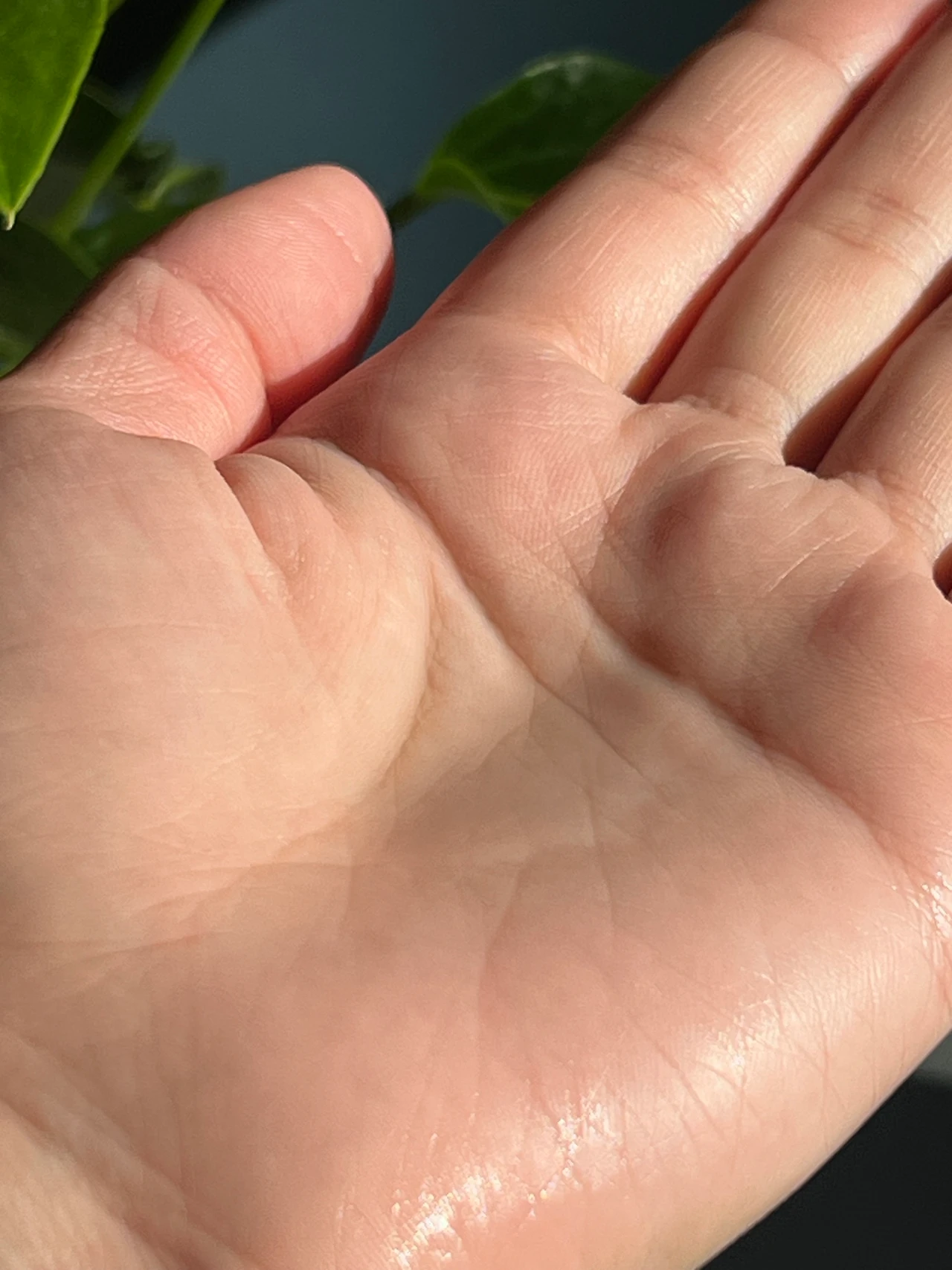 イハダ 薬用ローション(とてもしっとり)<医薬部外品>