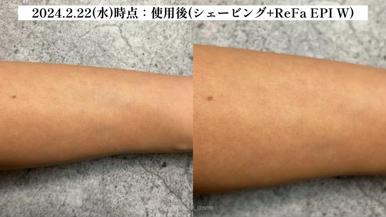 【2024年3月6日発売】ReFa(リファ)2大新作! 光美容器 “リファエピダブル ” とシャワーヘッド ” リファファインバブル U ” の体験速報!🚿✨【お家エステで美肌習慣】_10