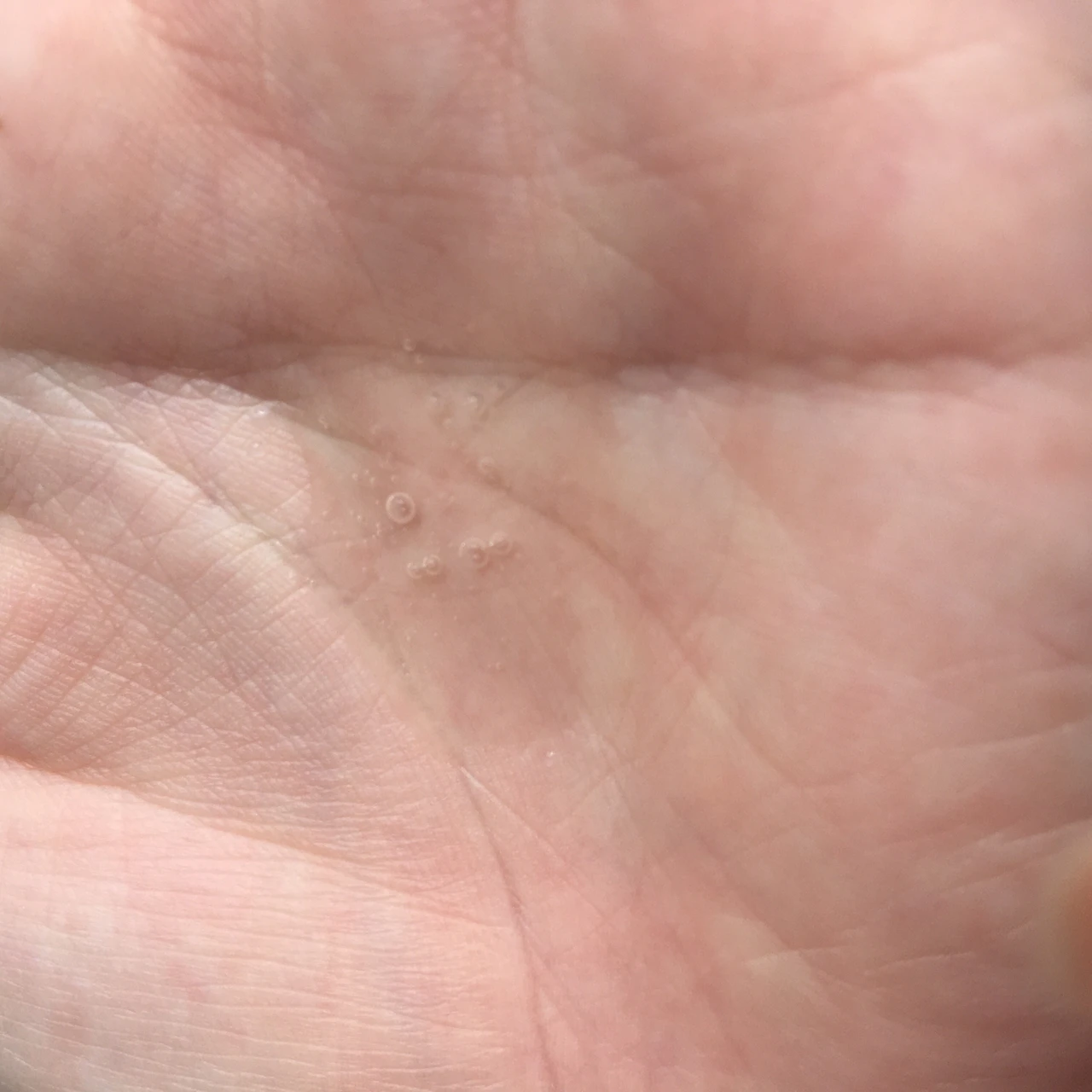 【温泉水パワーがすごい】肌調子がよくないときにもノンストレスで使えるシカ デイリーシリーズ【ユリア―ジュ】_2_2