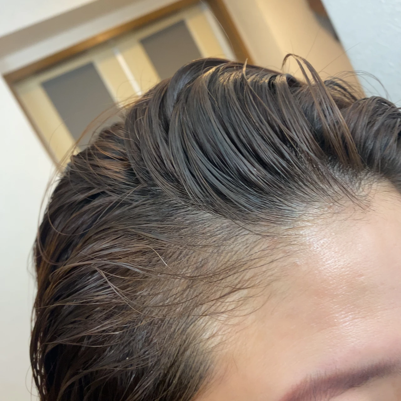 ines アクア チャージ ムース 頭皮ケア スカルプケア 炭酸美容ムース 炭酸美容 頭皮美容液 ヘアケア 保湿