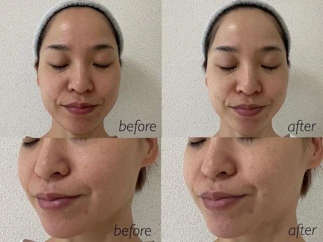 「デュオ ザ クレンジングバーム ホワイトa」ビフォーアフター