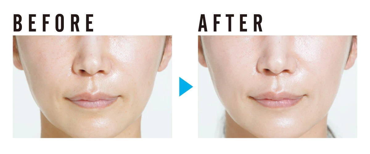 ラロッシュボゼ　larocheposay　UVイデア XL プロテクション トーンアップ ティント SPF50＋・PA++++　塗布ビフォーアフター