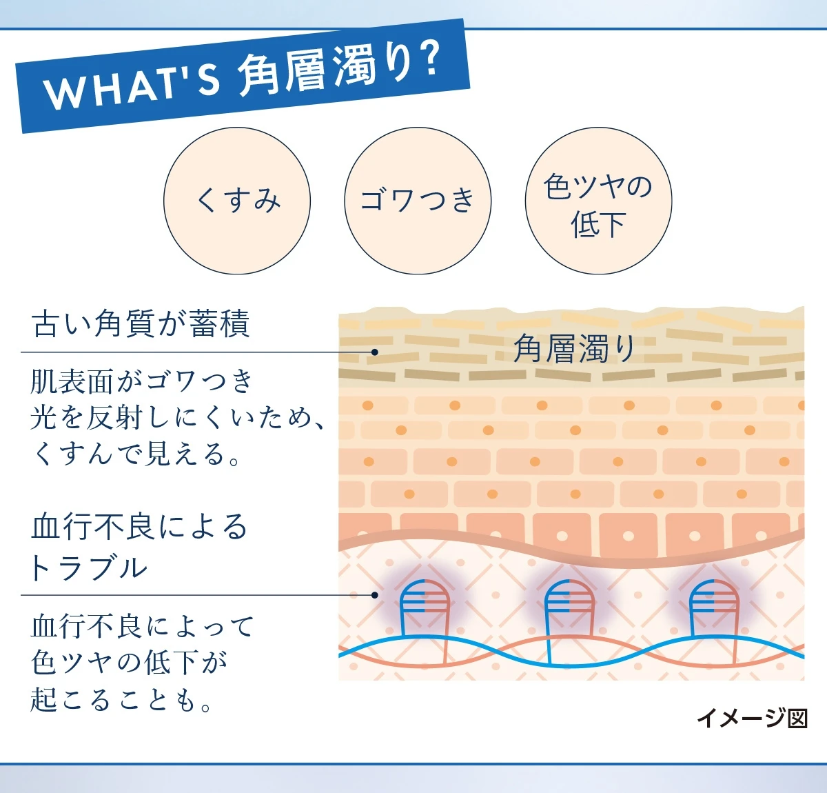 WHAT'S 角層濁り?
