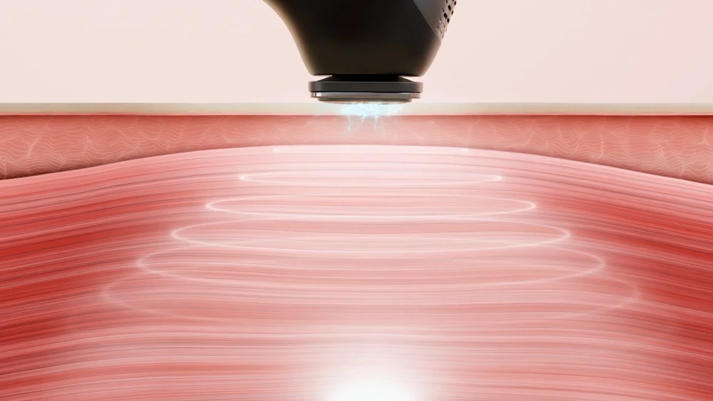 MiRAY ONE　美顔器　MYTREX　EMS