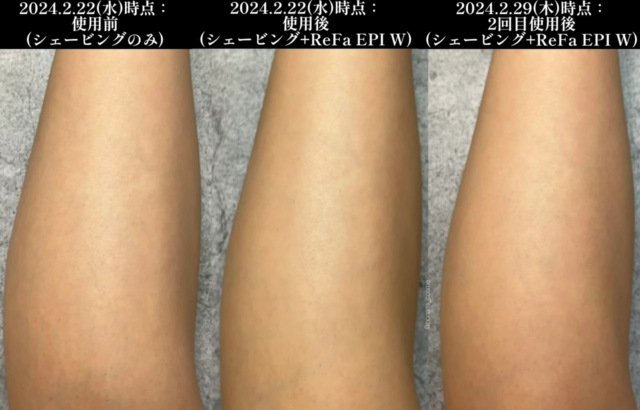 【2024年3月6日発売】ReFa(リファ)2大新作! 光美容器 “リファエピダブル ” とシャワーヘッド ” リファファインバブル U ” の体験速報!🚿✨【お家エステで美肌習慣】_16