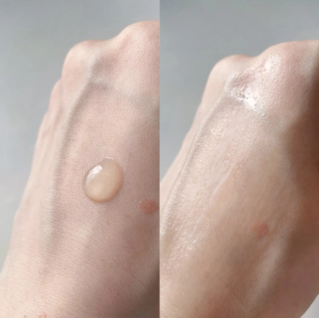 エーデルワイス コンセントレート セラム