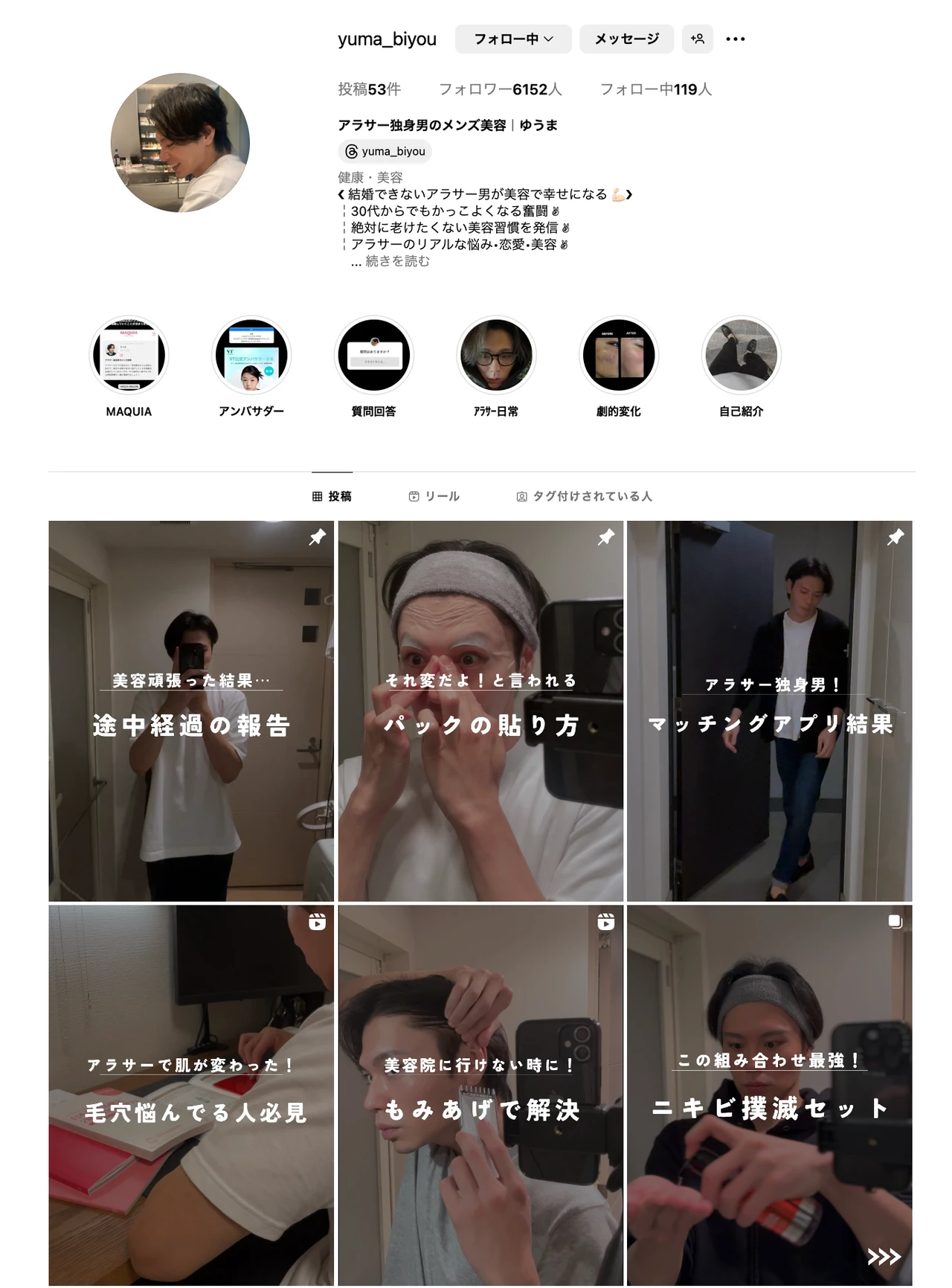 【対策は早いに越したことない！】夏に向けて美白ケア、何から始めるのが良い？_2