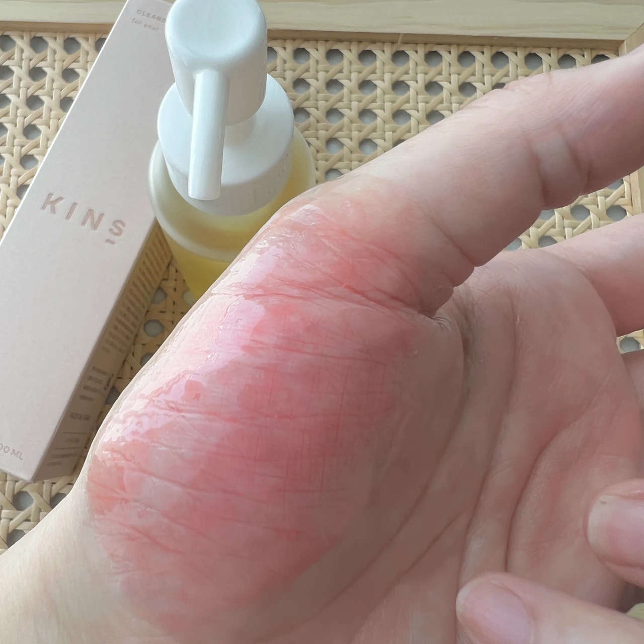 【肌の常在菌＆うるおいキープ】Ｗ洗顔不要のKINS CLEANSING OIL（キンズ クレンジングオイル）で皮脂詰まり・毛穴汚れケア【敏感肌の方も使える】_4_2