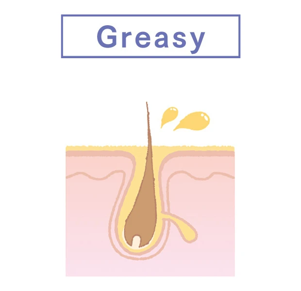 THE ANSWER ジアンサー 頭皮の肌質 Greasy