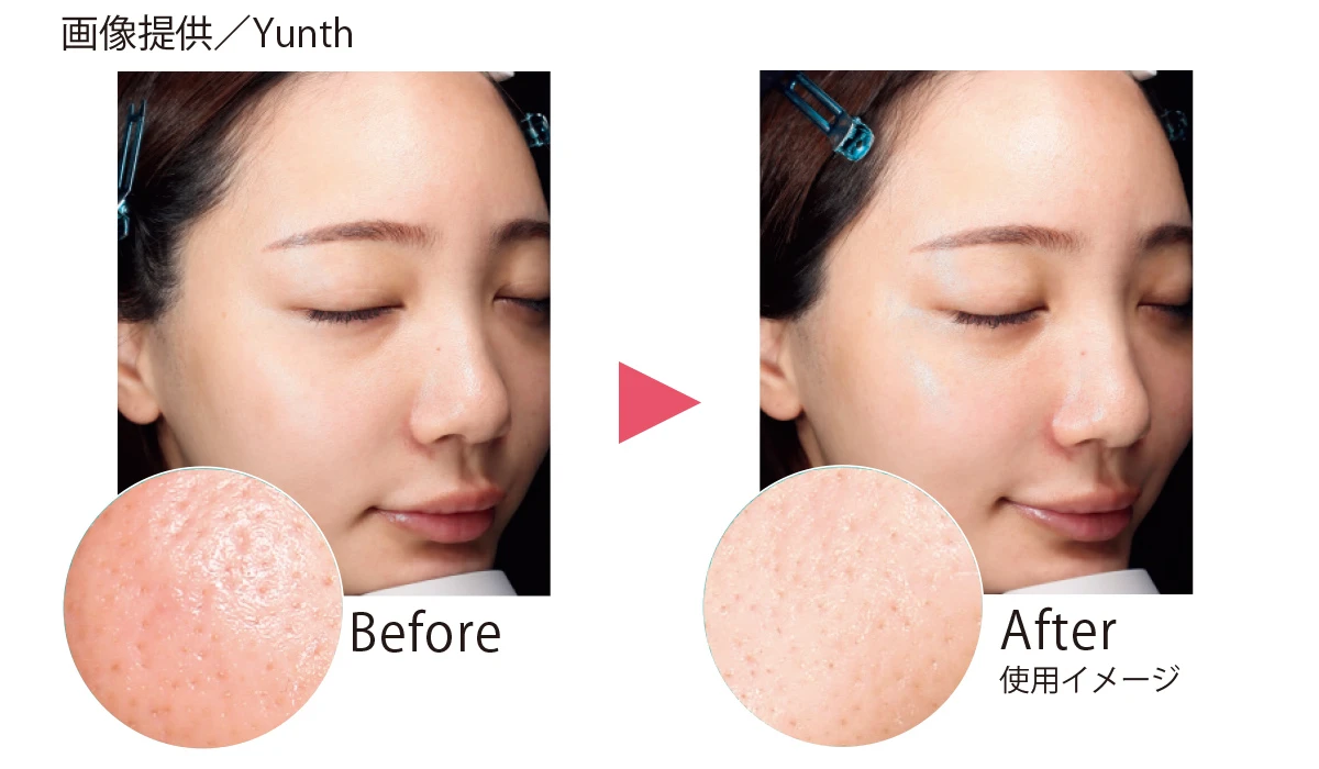 Yunth フュージョンクレンジング 使用前後 before after イメージ
