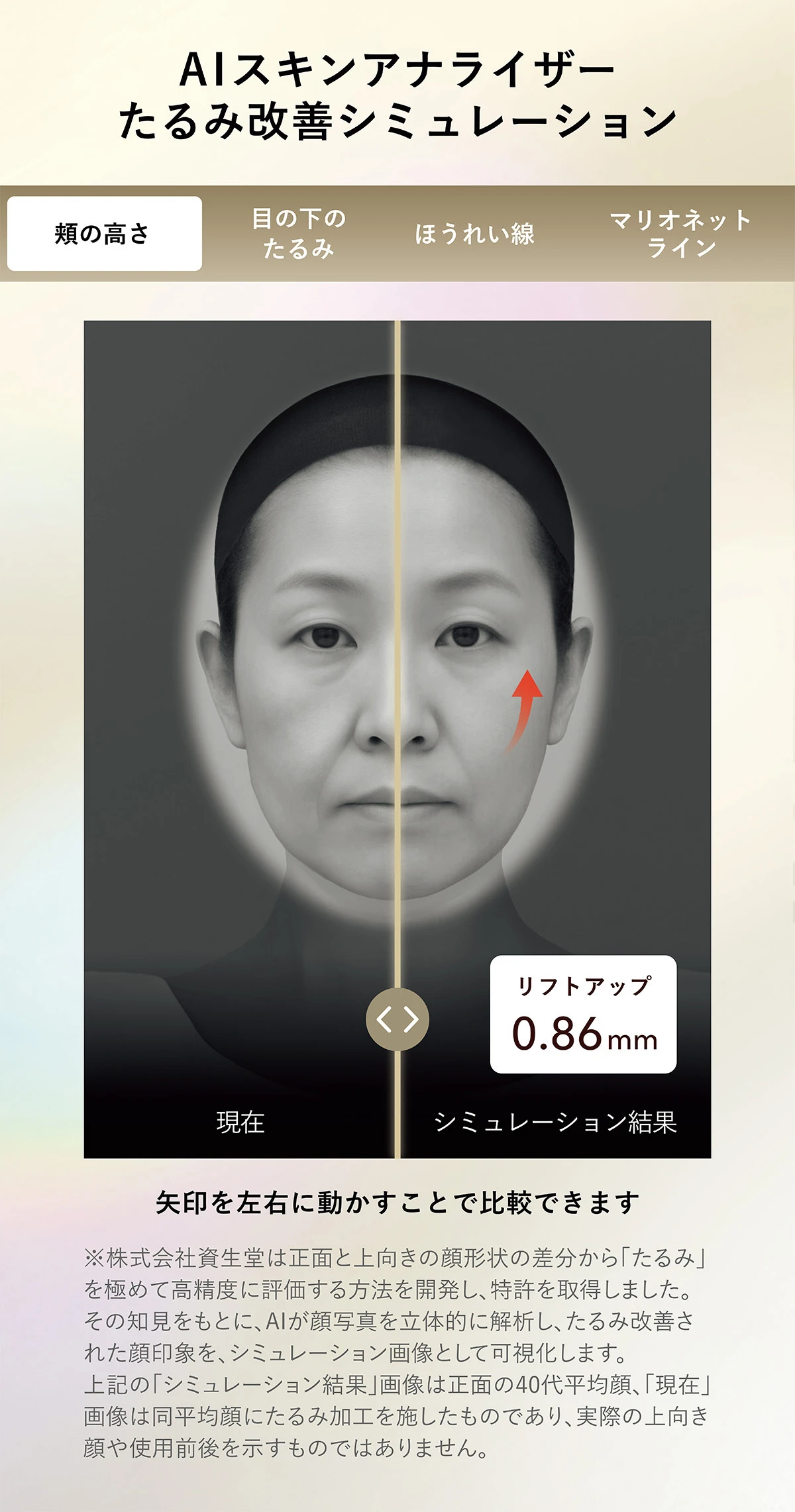 たるみ改善シミュレーション