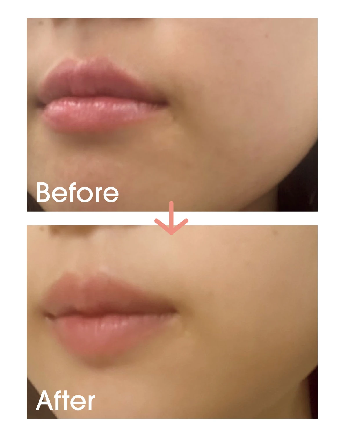 【詰まり毛穴】に悩む萩原(マキアエディター)before after