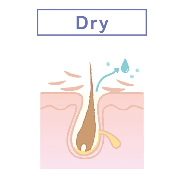 THE ANSWER ジアンサー 頭皮の肌質 Dry 