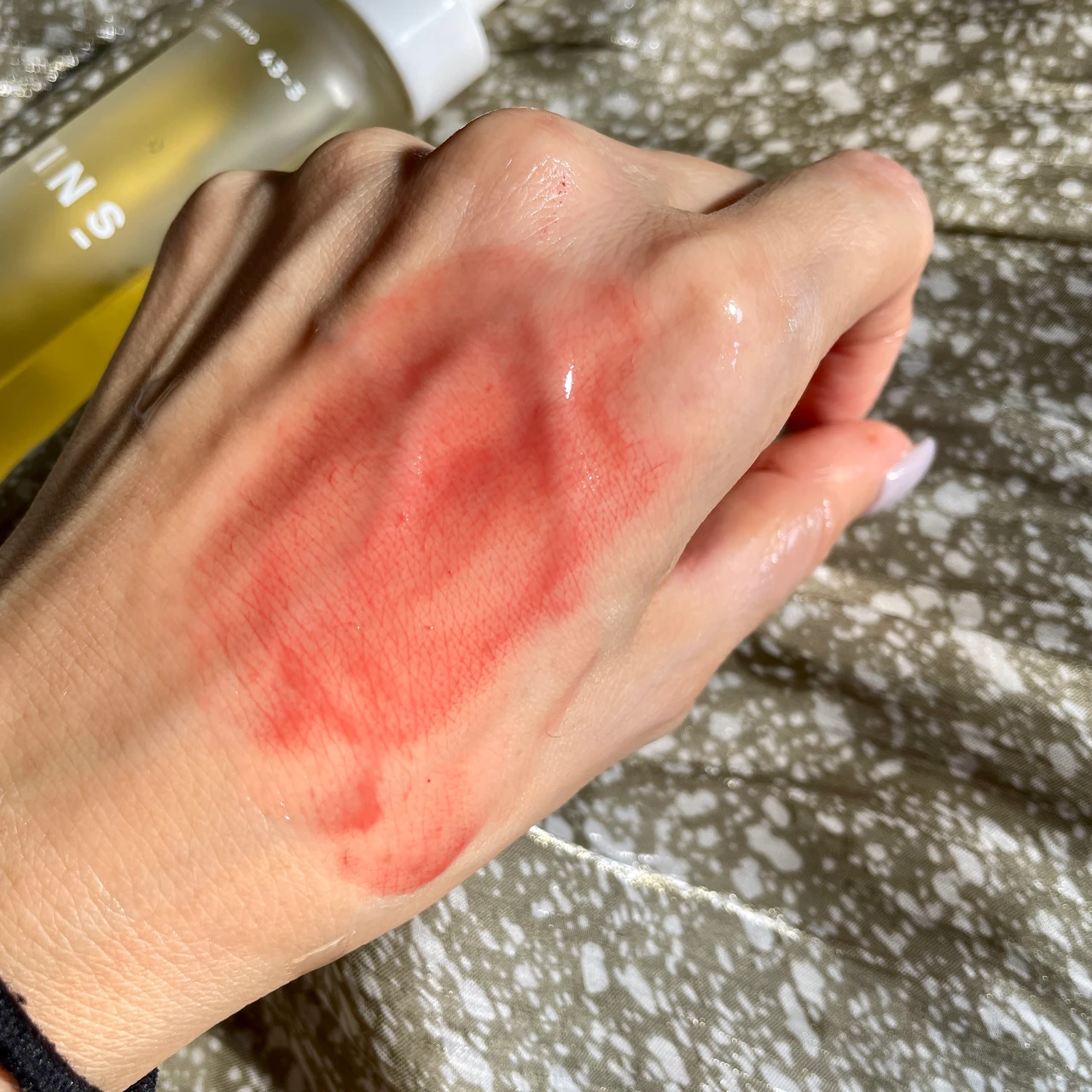 常在菌に着目！Ｗ洗顔不要【KINS CLEANSING OIL】植物由来オイルで敏感肌にもおすすめ！_7