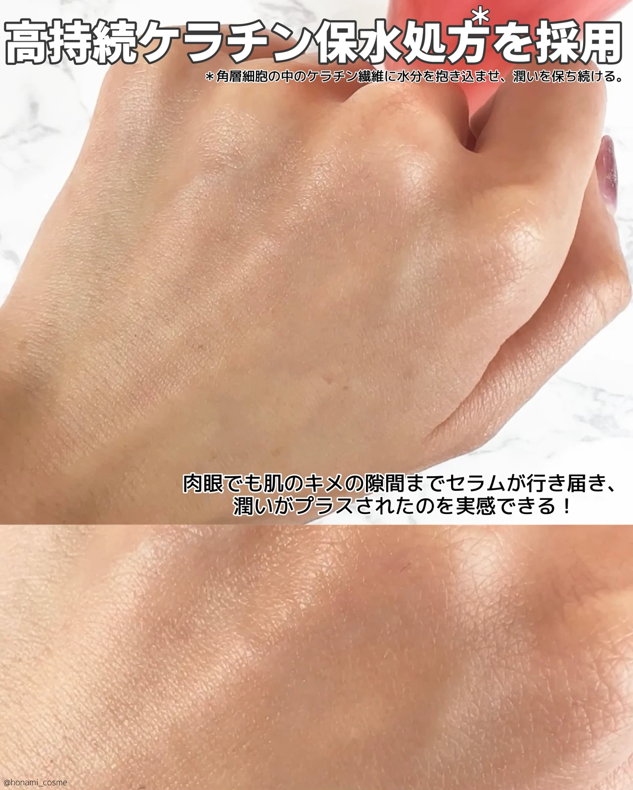 【エイジングケア】見せたくなる二の腕は、素敵な大人女性に魅せる!est(エスト)が提案する ” 大人の腕活 ” で美ボディ作り💖【カリスマ美容家の神崎恵さんも推す】_5