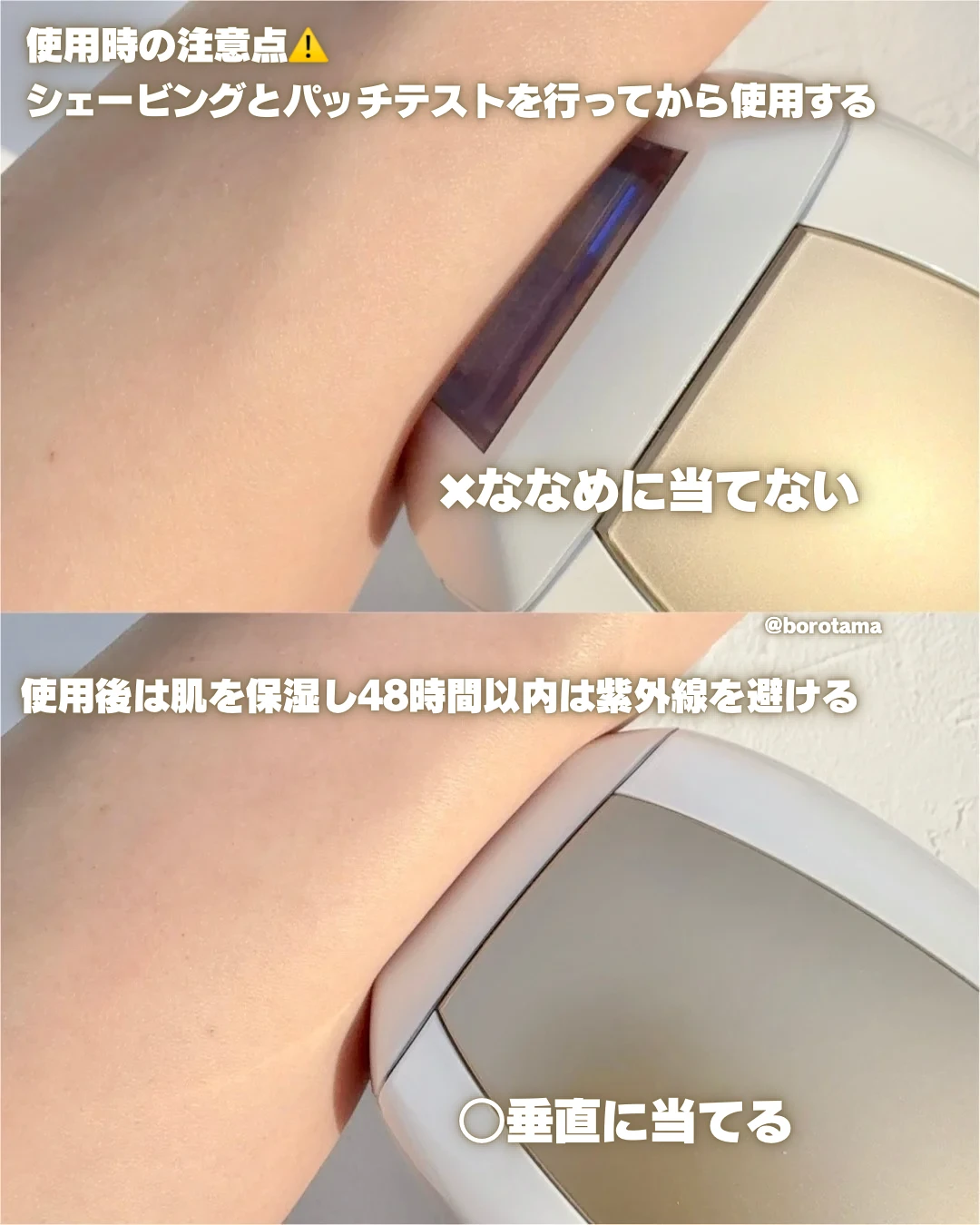 Ulike  Air 10 IPL光美容器