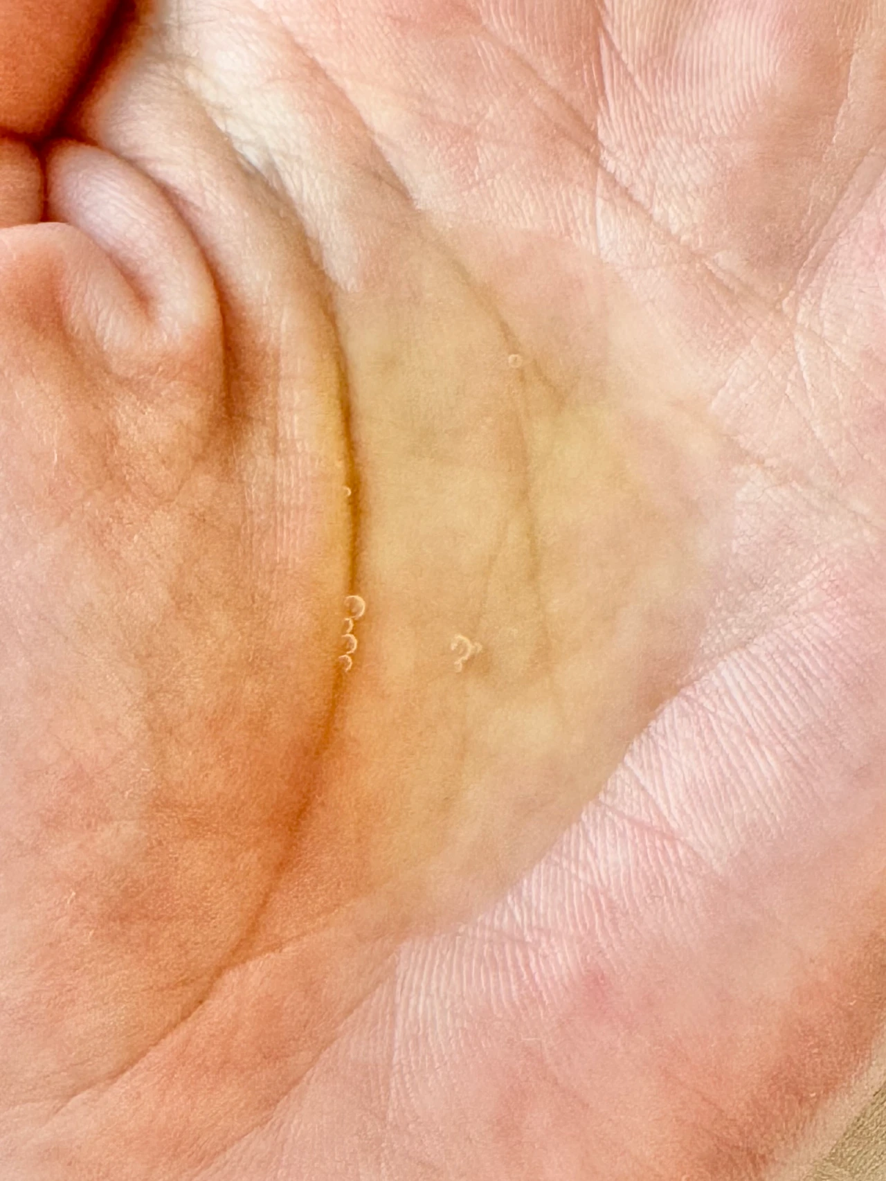 アンレーベルラボ　vエッセンス　ビタミンC 美容液