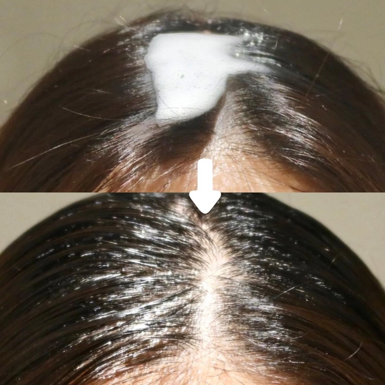 お風呂上がりの頭皮ケア・イネスのスカルプ保湿美容液!_2_2