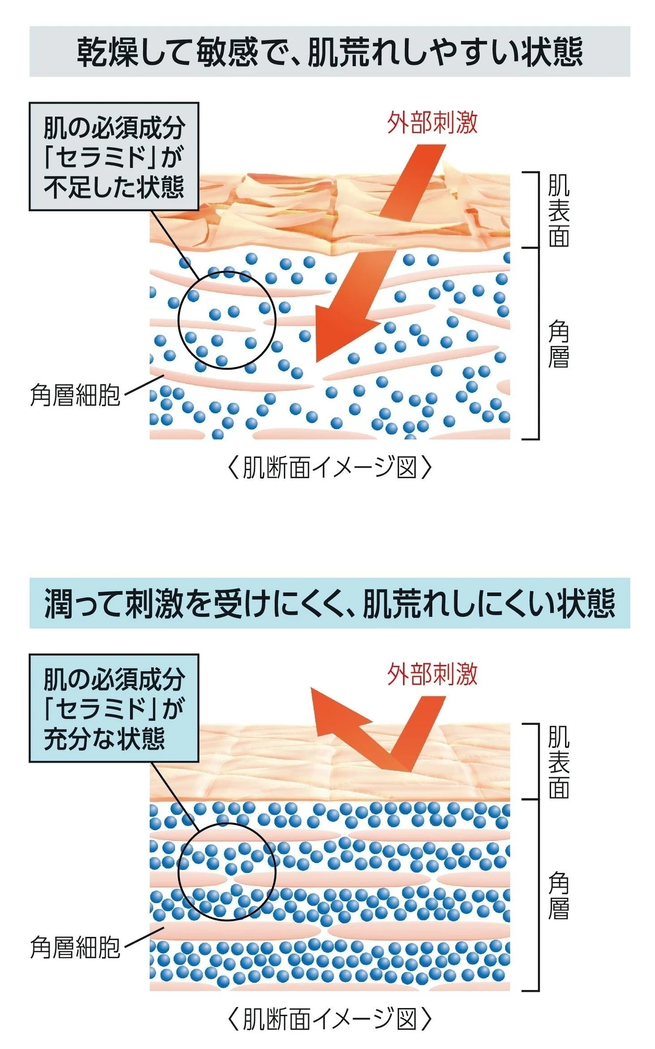 夏のカサつきの原因は“乾燥性敏感肌”のせいかも?
キュレルの保湿スプレーで、いつでもどこでも潤いチャージ_1