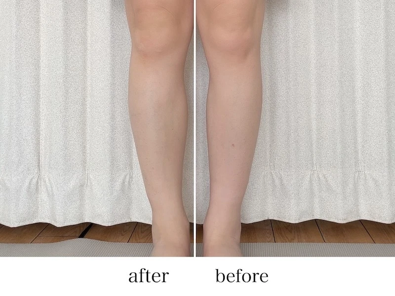 「エスト　インテンシブ　ボディセラム」ビフォーアフター