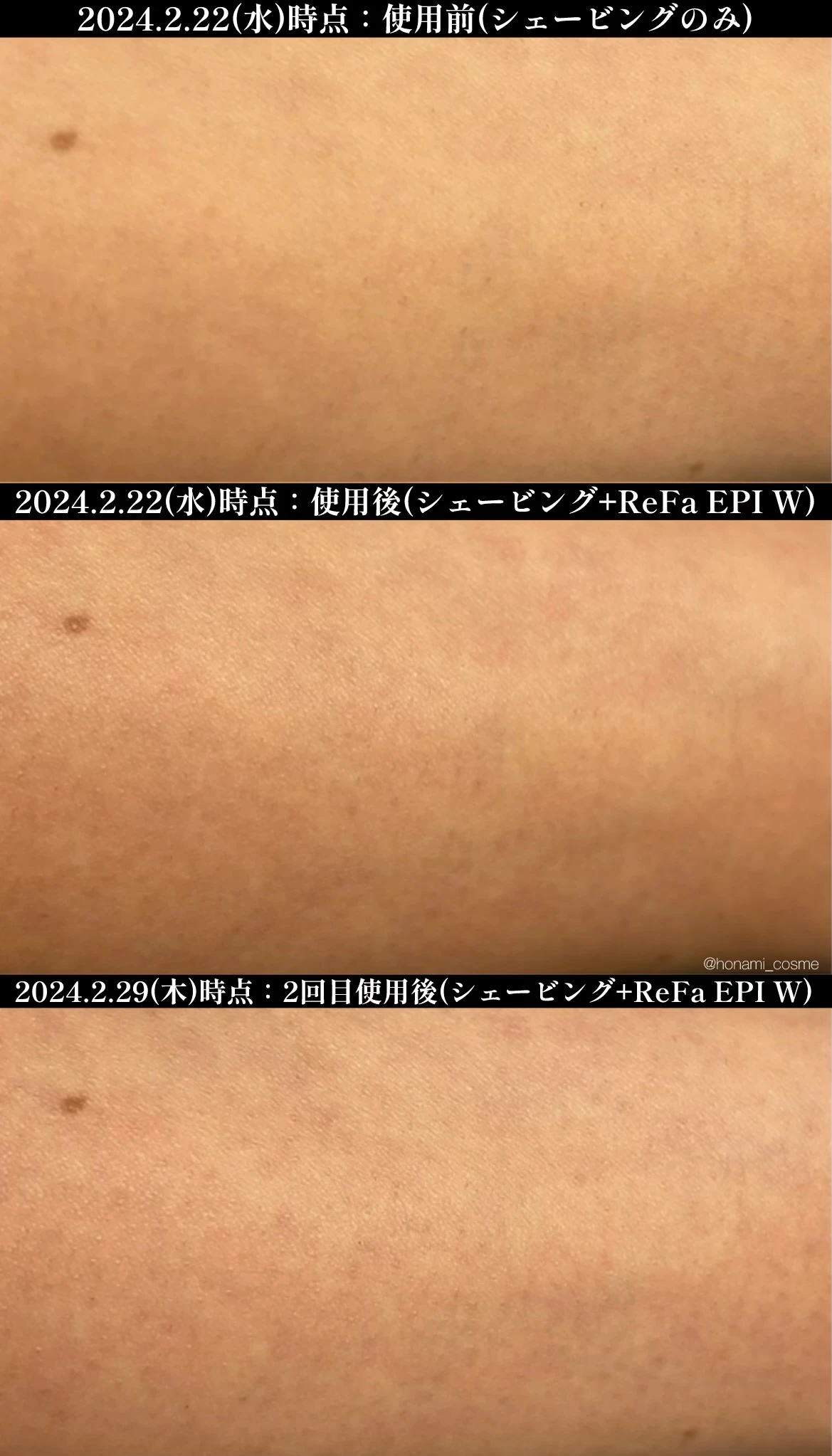 【2024年3月6日発売】ReFa(リファ)2大新作! 光美容器 “リファエピダブル ” とシャワーヘッド ” リファファインバブル U ” の体験速報!🚿✨【お家エステで美肌習慣】_12