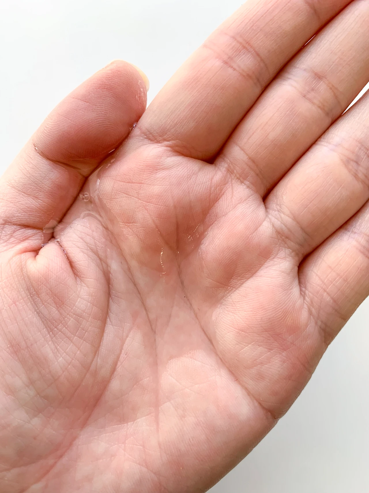 イハダ 薬用ローション(とてもしっとり)〈医薬部外品〉