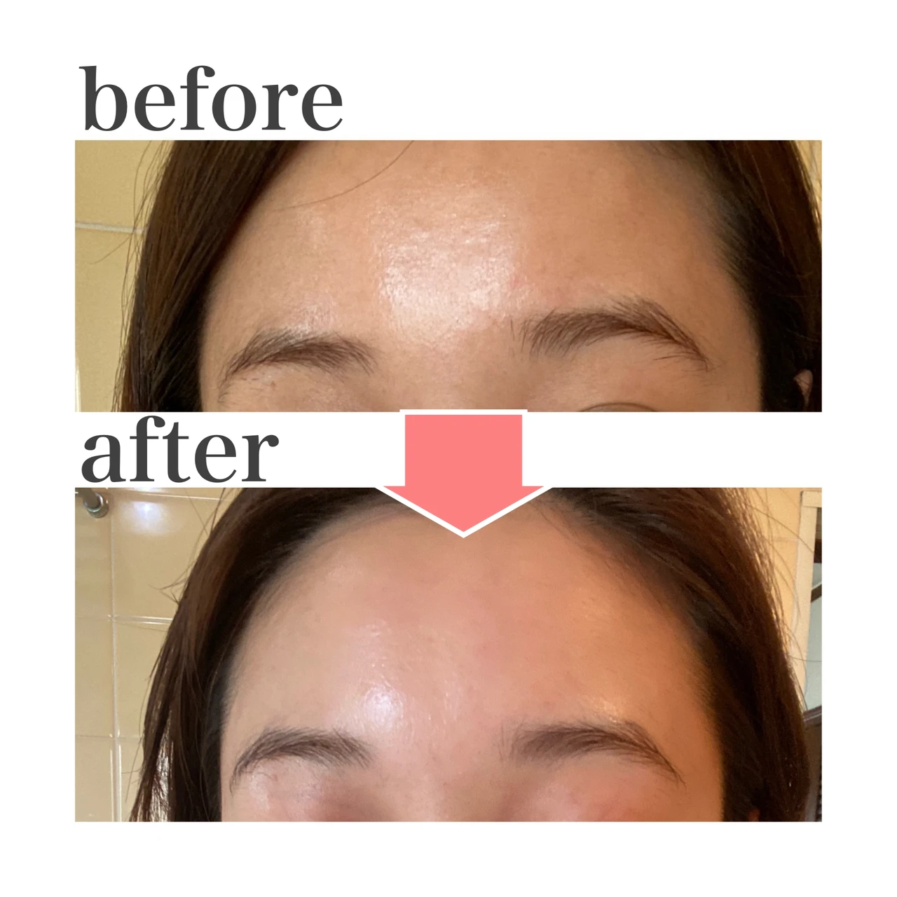 【2週間で肌質改善】オバジc25セラムneoを試してみた_3