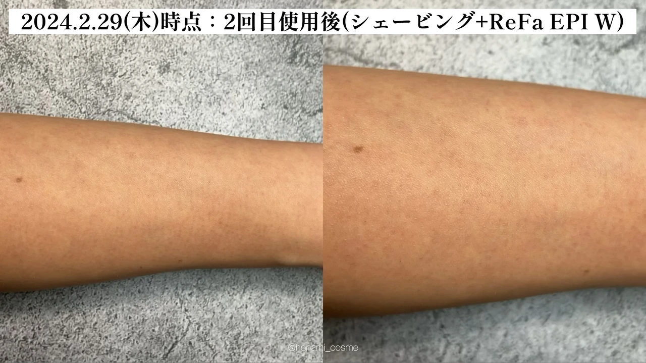 【2024年3月6日発売】ReFa(リファ)2大新作! 光美容器 “リファエピダブル ” とシャワーヘッド ” リファファインバブル U ” の体験速報!🚿✨【お家エステで美肌習慣】_11