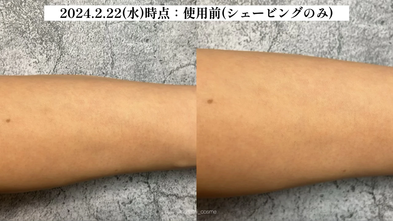 【2024年3月6日発売】ReFa(リファ)2大新作! 光美容器 “リファエピダブル ” とシャワーヘッド ” リファファインバブル U ” の体験速報!🚿✨【お家エステで美肌習慣】_9