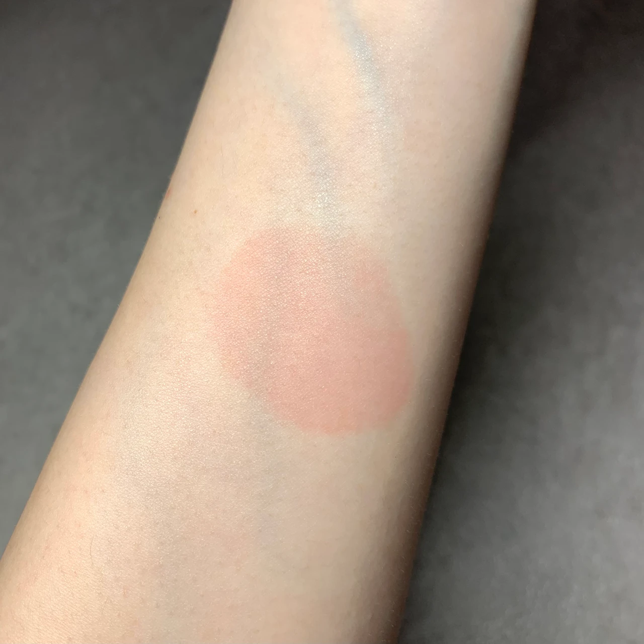 シワ改善・シミ予防ができる炭酸泡美容液！estの最新エイジングケア【エスト セラム ワン アドバンスド】_7