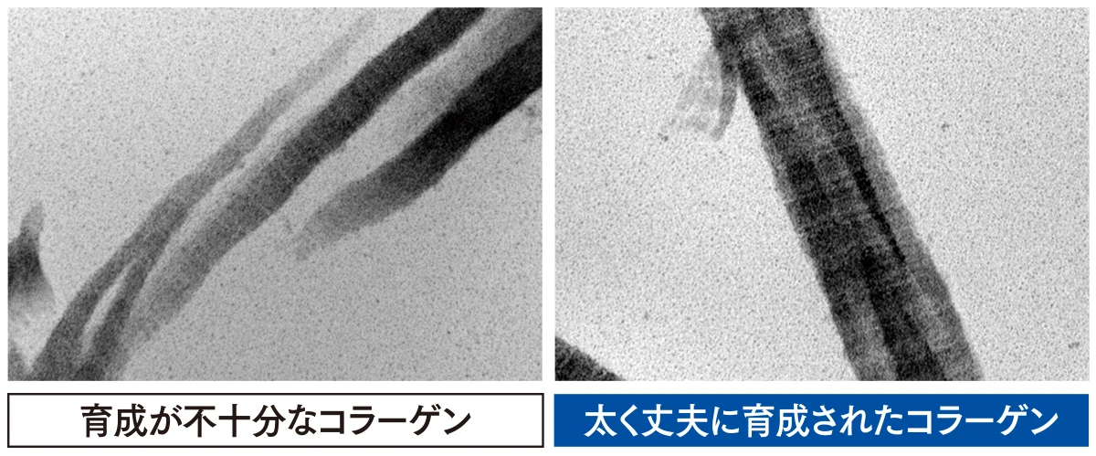 いいコラーゲン　悪いコラーゲン