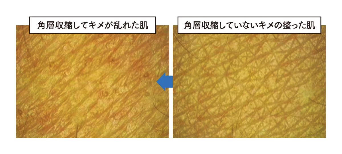 2 資生堂の着目 そもそも、「角層縮み」って、何? 図