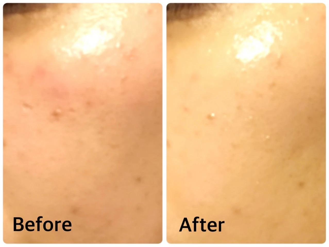 「マキア×ルルルンスペシャルウェビナー」参加し、2週間ルルルンプレシャス GREEN使ってみました！_4