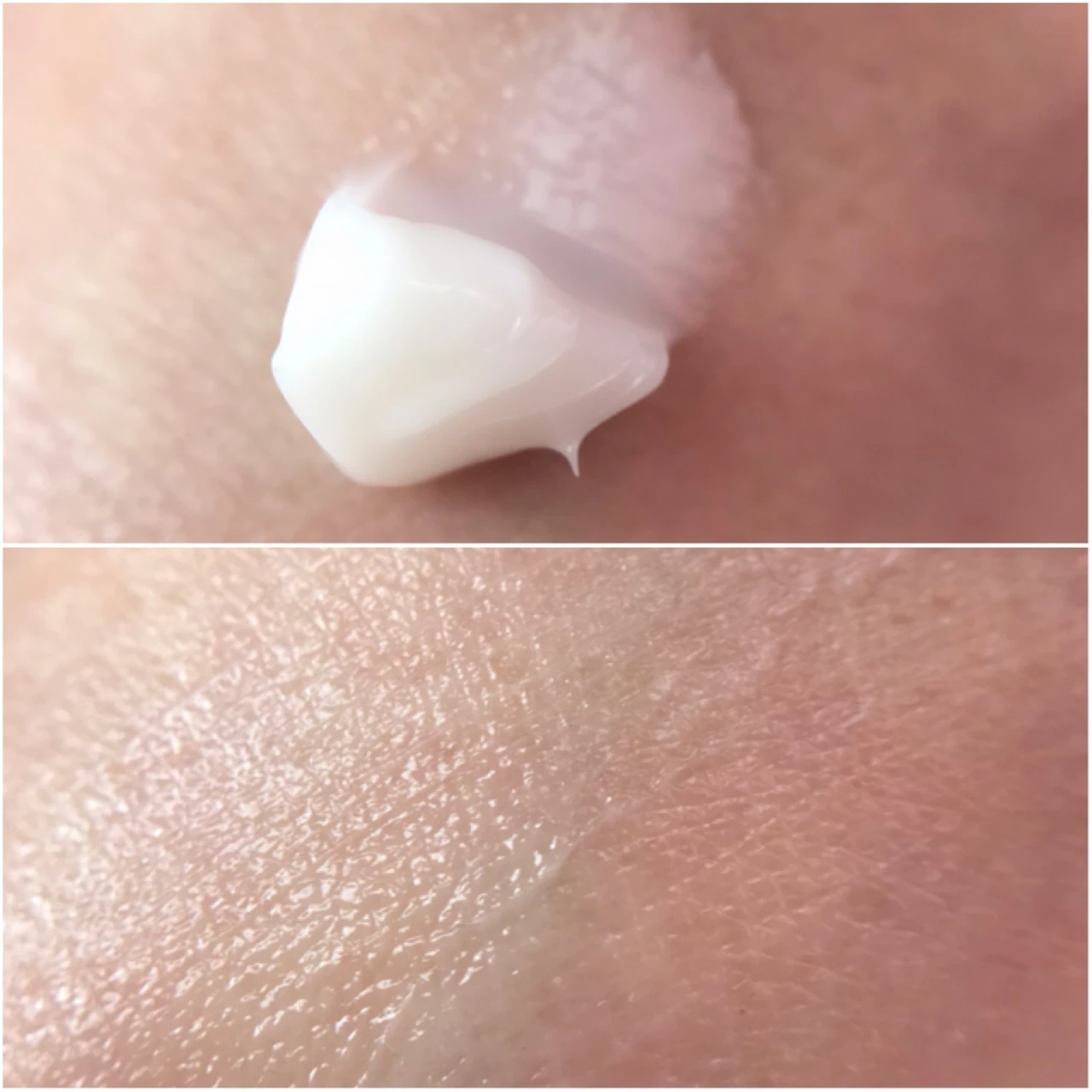 オバジX ダーマアドバンストリフト