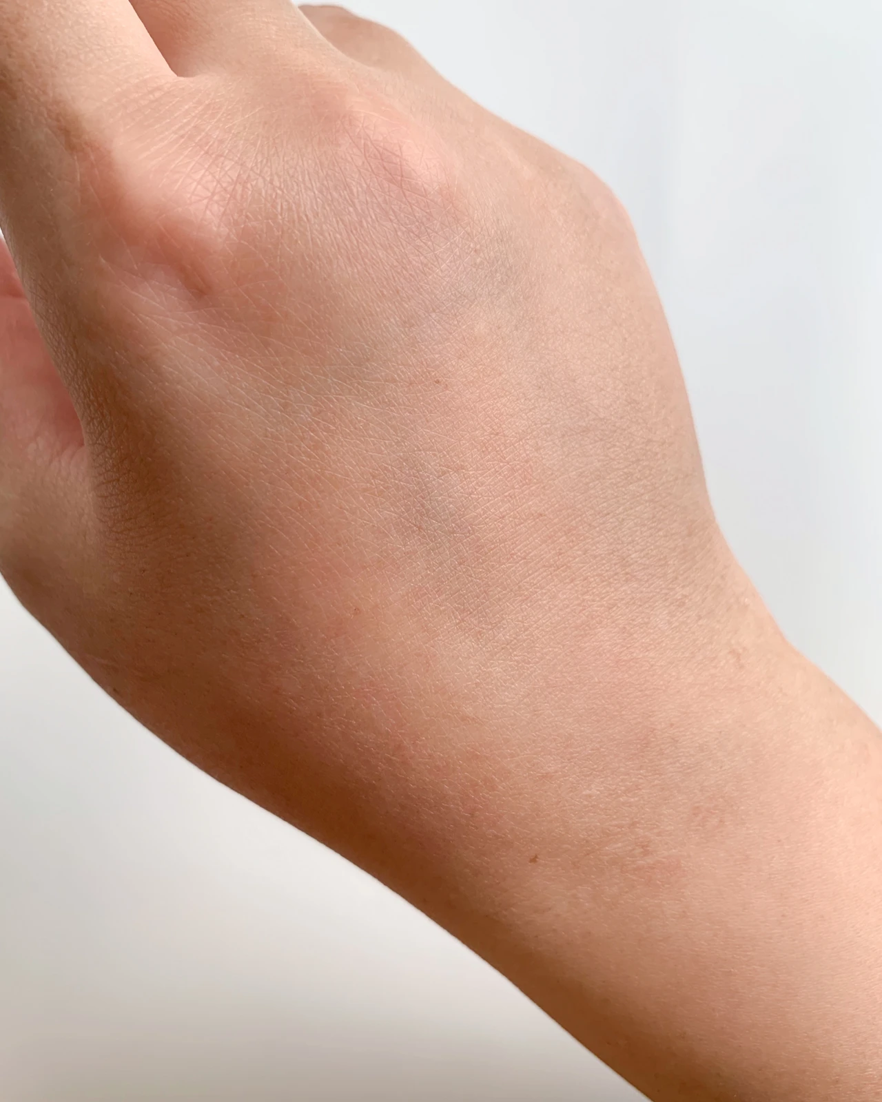 リファエピダブル