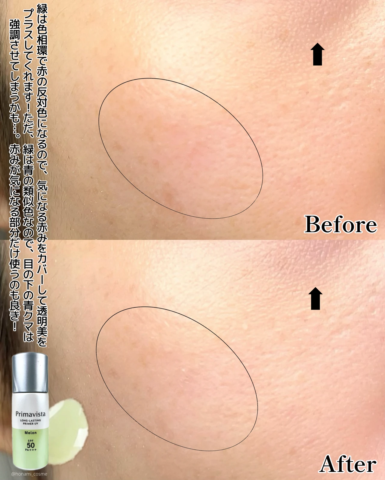 【Primavista(プリマヴィスタ)】化粧崩れ防止効果×紫外線カット(日焼け止め)効果のハイブリット夏下地を全色徹底比較レビュー！肌悩みごとのおすすめ使用法解説まで盛りだくさん🌞✨【補色チャートあり】_10