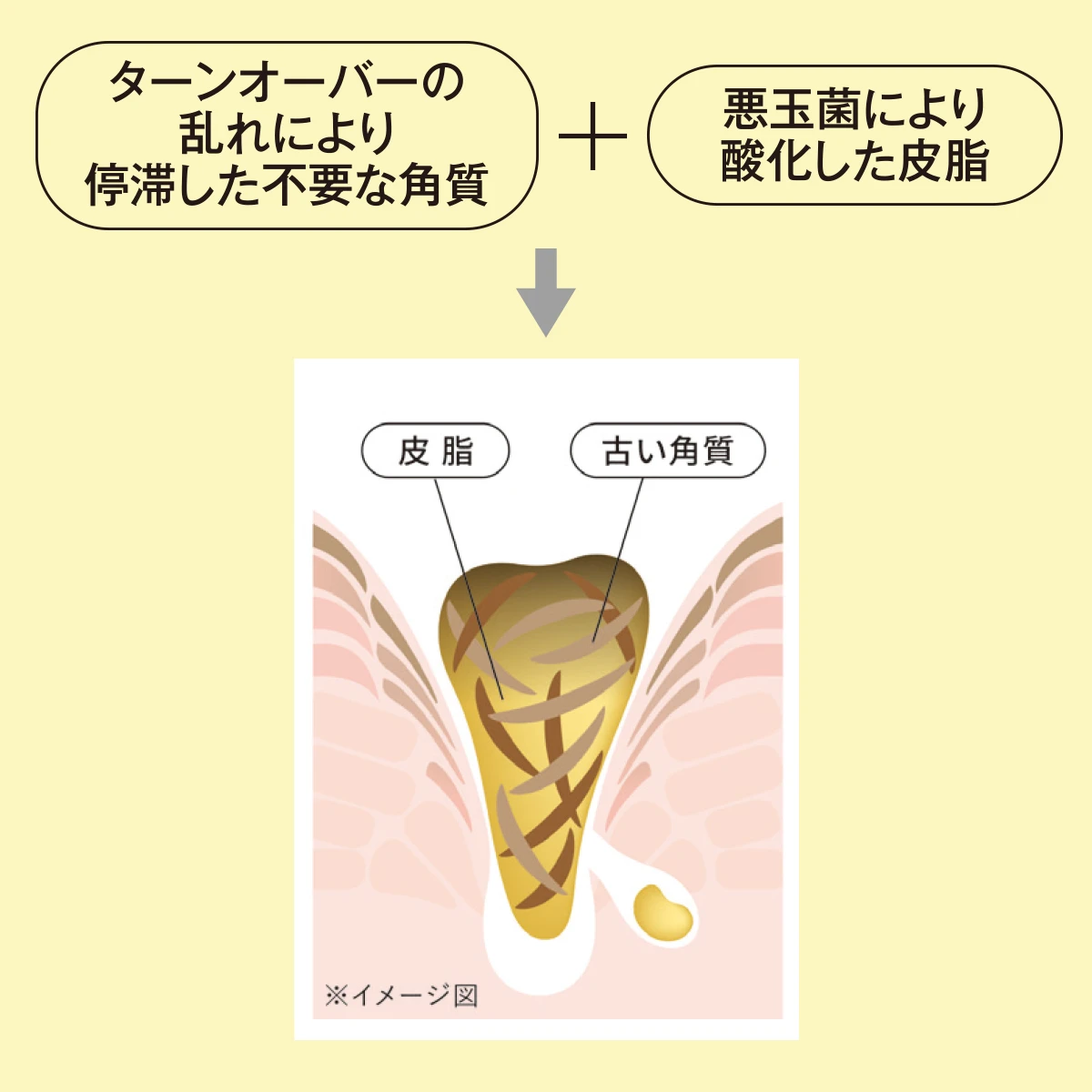 ターンオーバー 角質 毛穴 角栓 悪玉菌 皮脂