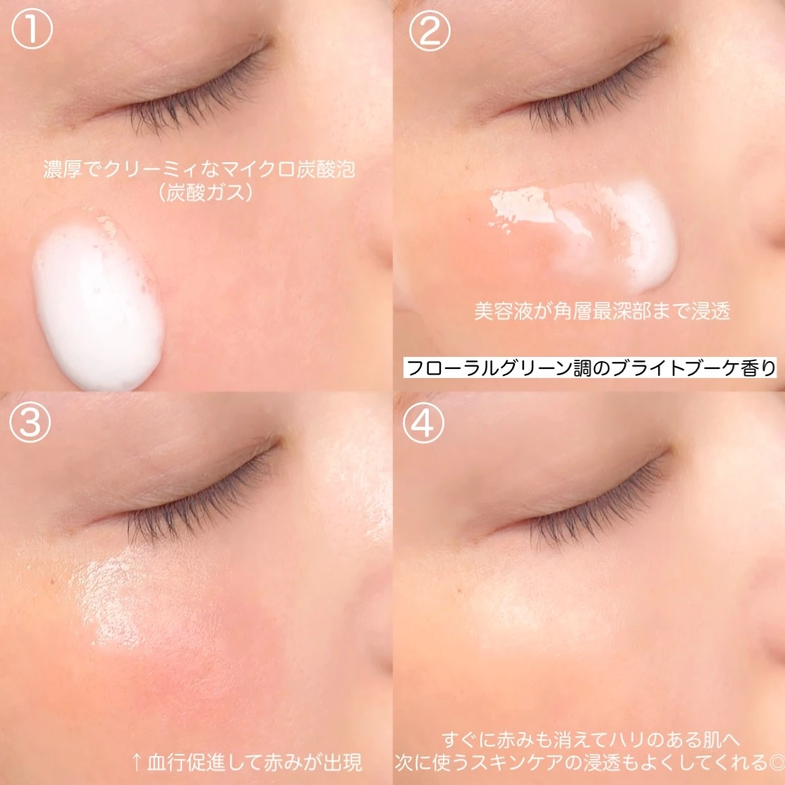 【新発売!炭酸泡でシミ・シワ改善。これ以上の美容液、私はみたことがない。】_3