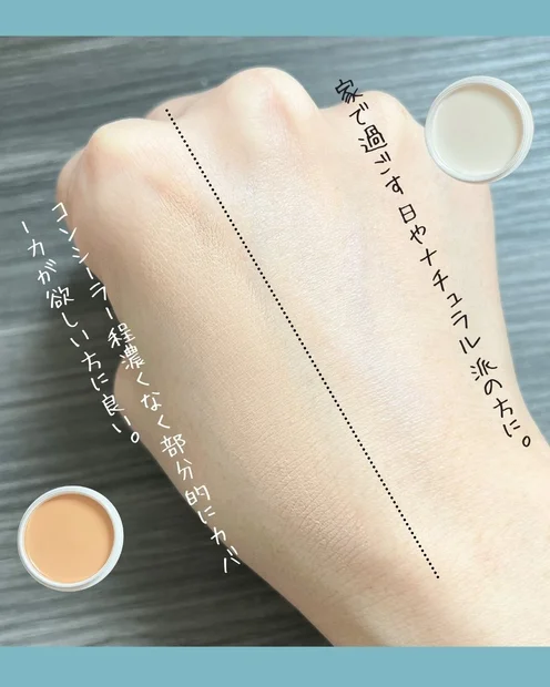 乾燥肌&ダウンタイムのお共に【お守りバーム】が便利だった！