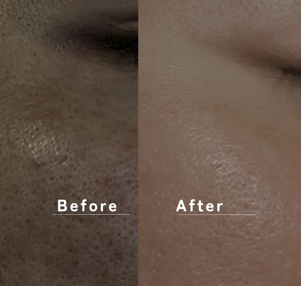 【アラサー美容男子の実体験】肌がゆらぎやすいこの時期、頼れるクレンジングを発見