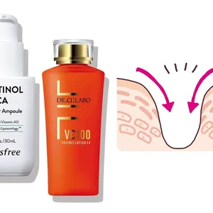 友利新先生　たるみ毛穴　毛穴　スキンケア