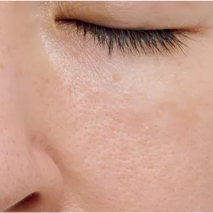 【悩み別】毛穴を目立たなくする方法 PhotoGallery_1_28