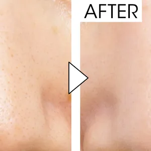 マキア　毛穴ケア　おすすめ　エスト　ジェリオロジー プライマー M